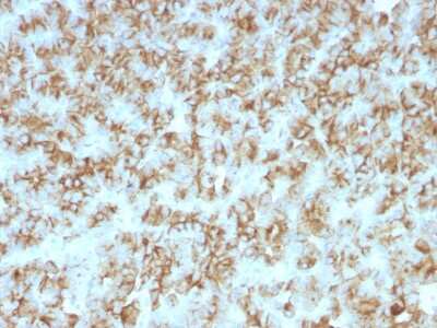 Immunohistochemistry-Paraffin: PTH Antibody (PTH/911) - N-terminal [NBP2-45111]