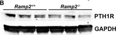 Western Blot: PTH1R/PTHR1 Antibody (3D1.1) [NBP1-40067]