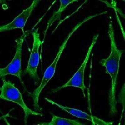 Immunocytochemistry/ Immunofluorescence: PTH1R/PTHR1 Antibody (4D2) - BSA Free [NBP1-51640]