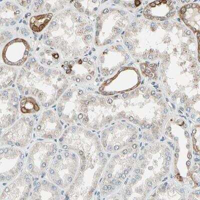 Immunohistochemistry: PTH1R/PTHR1 Antibody [NBP1-87192]