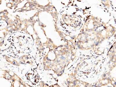 Immunohistochemistry-Paraffin: PTH1R/PTHR1 Antibody [NBP2-99962]