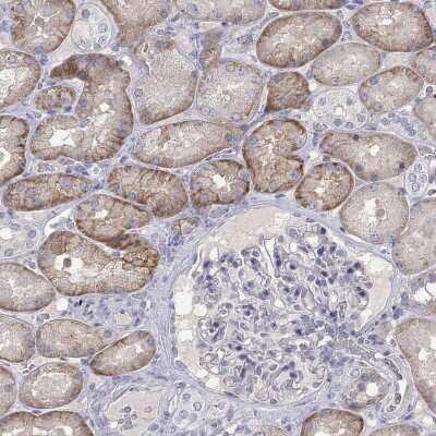 Immunohistochemistry-Paraffin: PTH1R/PTHR1 Antibody [NBP3-16996]