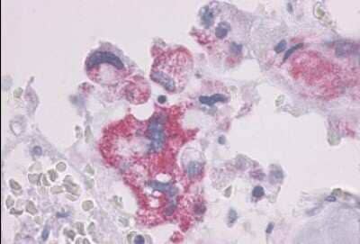 Immunohistochemistry-Paraffin: PTH1R/PTHR1 Antibody - BSA Free [NLS761]