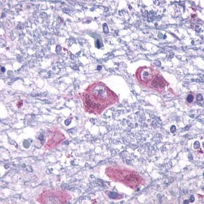 Immunohistochemistry-Paraffin: PTH2R Antibody - BSA Free [NLS249]