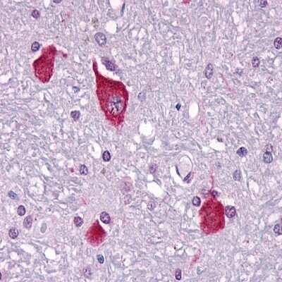 Immunohistochemistry-Paraffin: PTH2R Antibody - BSA Free [NLS250]