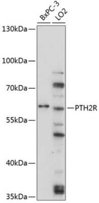 Western Blot: PTH2R AntibodyBSA Free [NBP2-94871]