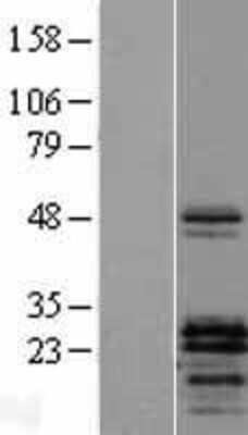 Western Blot: PTHLH/PTHrP Overexpression Lysate [NBL1-14948]