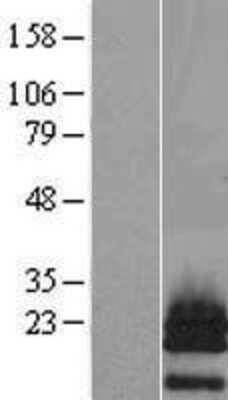 Western Blot: PTHLH/PTHrP Overexpression Lysate [NBL1-14949]