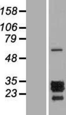 Western Blot: PTHLH/PTHrP Overexpression Lysate [NBP2-04637]