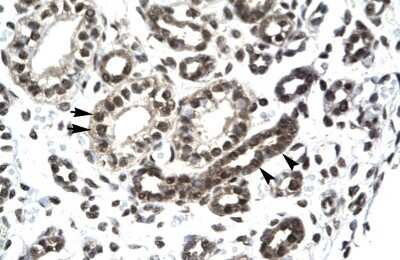 Immunohistochemistry-Paraffin: PTHLH/PTHrP Antibody [NBP1-59322]