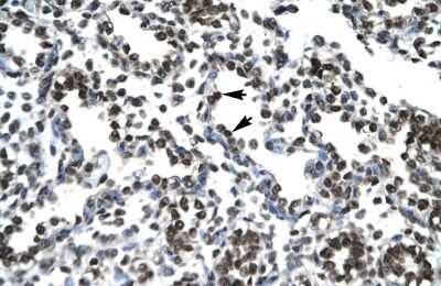 Immunohistochemistry-Paraffin: PTHLH/PTHrP Antibody [NBP1-59322]