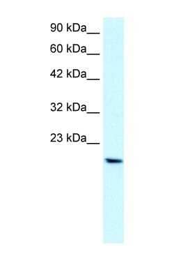 Western Blot: PTHLH/PTHrP Antibody [NBP1-59322]