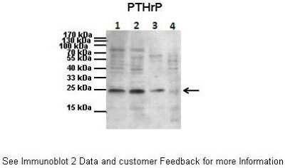 Western Blot: PTHLH/PTHrP Antibody [NBP1-59322]