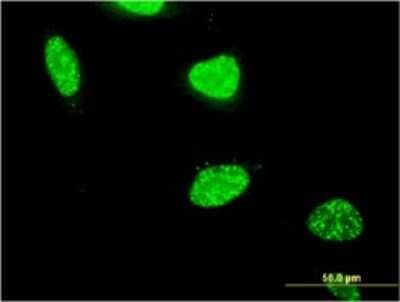 Immunocytochemistry/ Immunofluorescence: PTIP Antibody (4C11) [H00022976-M02]