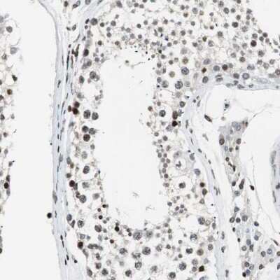 Immunohistochemistry-Paraffin: PTIP Antibody [NBP1-88233]