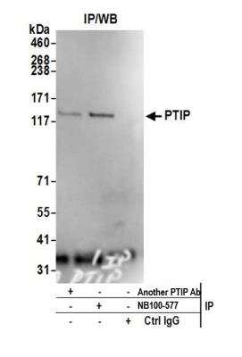 Immunoprecipitation: PTIP Antibody [NB100-577]