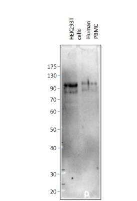 Western Blot: PTIP Antibody [NBP3-12230]