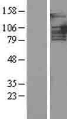 Western Blot: PTIP Overexpression Lysate [NBL1-14134]