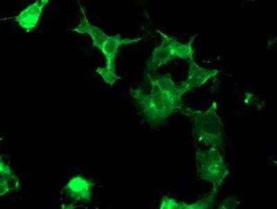 Immunocytochemistry/ Immunofluorescence: PTK7/CCK4 Antibody (OTI2E7) [NBP2-01486]