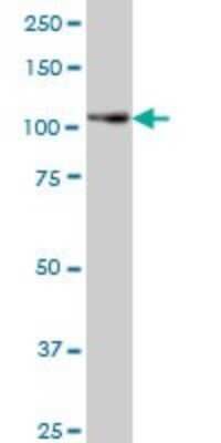 Western Blot: PTK7/CCK4 Antibody (4F5) [H00005754-M06]