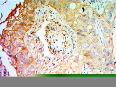 Immunohistochemistry-Paraffin: PTK7/CCK4 Antibody (4F9) - BSA Free [NBP1-51633]
