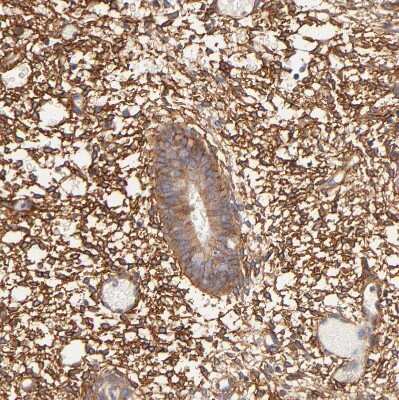 Immunohistochemistry-Paraffin: PTK7/CCK4 Antibody [NBP1-88157]