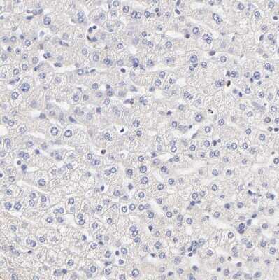 Immunohistochemistry-Paraffin: PTK7/CCK4 Antibody [NBP1-88157]