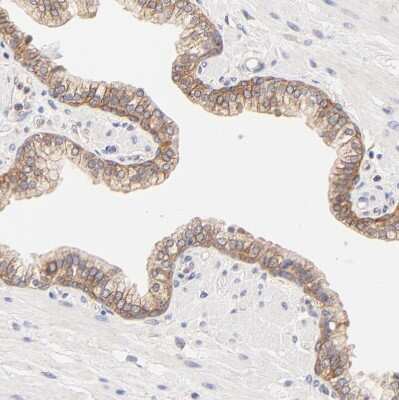 Immunohistochemistry-Paraffin: PTK7/CCK4 Antibody [NBP1-88157]