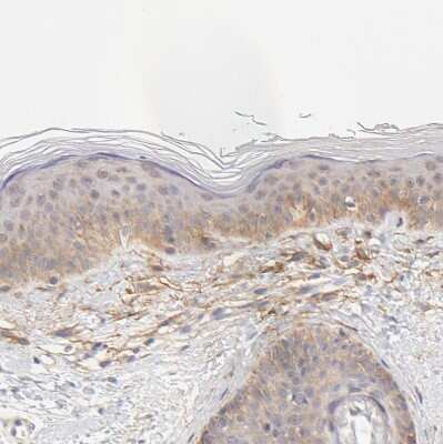 Immunohistochemistry-Paraffin: PTK7/CCK4 Antibody [NBP1-88157]