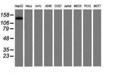 Western Blot: PTK7/CCK4 Antibody (OTI2E7)Azide and BSA Free [NBP2-73708]