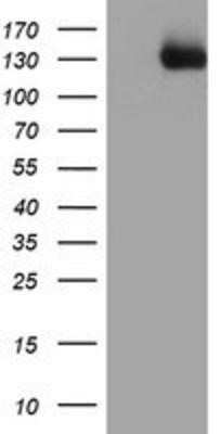 Western Blot: PTK7/CCK4 Antibody (OTI2E7)Azide and BSA Free [NBP2-73708]