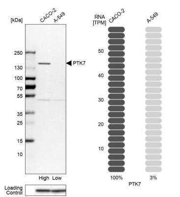 Western Blot: PTK7/CCK4 Antibody [NBP1-88157]