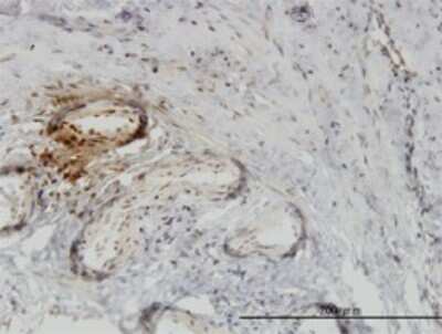 Immunohistochemistry-Paraffin: PTK9 Antibody (1E2) [H00005756-M02]
