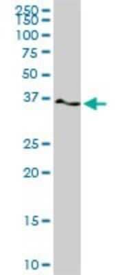 Western Blot: PTK9 Antibody (1E2) [H00005756-M02]