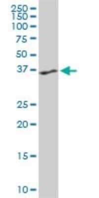 Western Blot: PTK9 Antibody (5C4) [H00005756-M06]