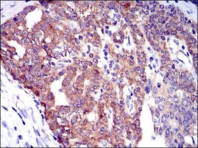 Immunohistochemistry: PTK9 Antibody (7C11) - BSA Free [NBP2-37456]