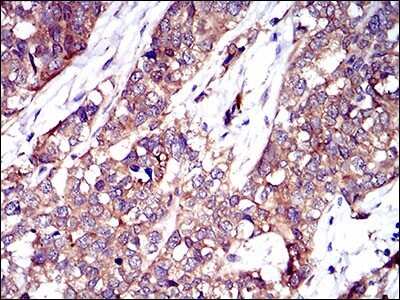 Immunohistochemistry: PTK9 Antibody (7C11) - BSA Free [NBP2-37456]