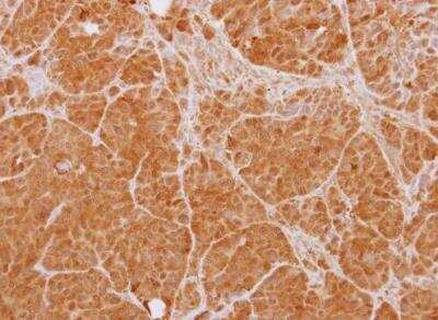 Immunohistochemistry-Paraffin: PTK9 Antibody [NBP1-33132]