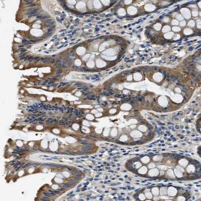 Immunohistochemistry-Paraffin: PTK9 Antibody [NBP1-90297]