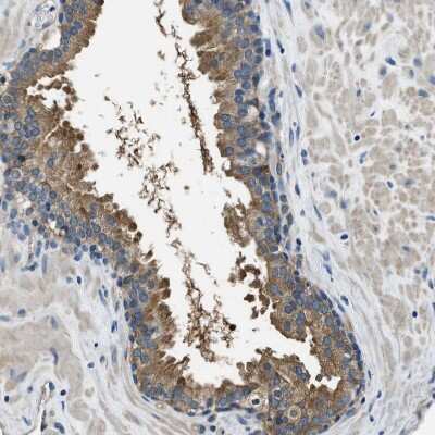 Immunohistochemistry-Paraffin: PTK9 Antibody [NBP1-90297]
