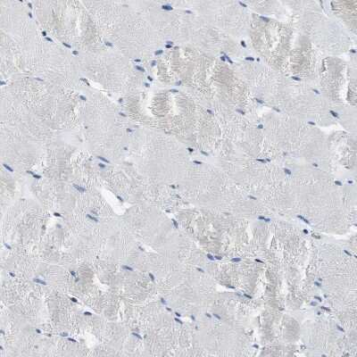Immunohistochemistry-Paraffin: PTK9 Antibody [NBP1-90297]