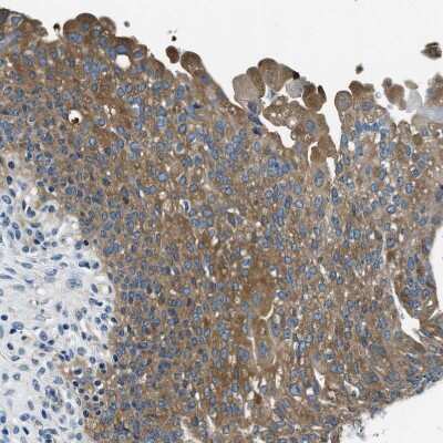 Immunohistochemistry-Paraffin: PTK9 Antibody [NBP1-90297]