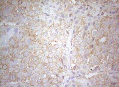 Immunohistochemistry-Paraffin: PTK9 Antibody (OTI5C12) [NBP2-46251]