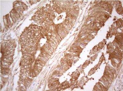 Immunohistochemistry-Paraffin: PTK9 Antibody (OTI5C12) [NBP2-46251]