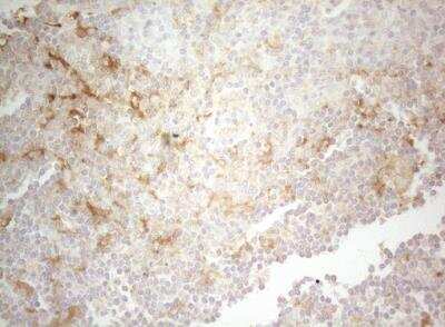 Immunohistochemistry-Paraffin: PTK9 Antibody (OTI5C12) [NBP2-46251]