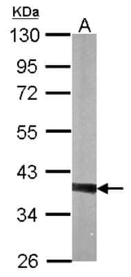 Western Blot: PTK9 Antibody [NBP1-33132]