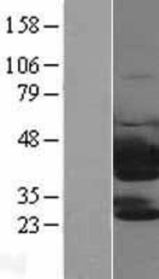 Western Blot: PTK9 Overexpression Lysate [NBL1-17458]