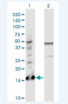 Western Blot: PTMS Antibody (3H5) [H00005763-M17-100ug]