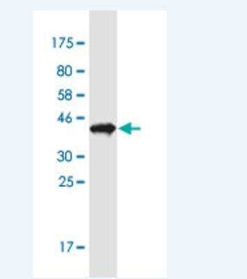 Western Blot: PTMS Antibody (3H5) [H00005763-M17-100ug]