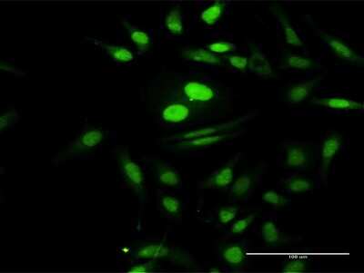 Immunocytochemistry/ Immunofluorescence: PTMS Antibody [H00005763-D01P]